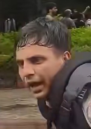 Flagged face